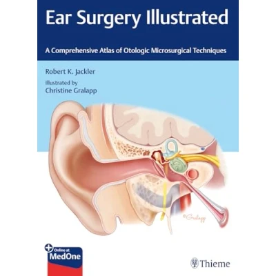 Bild av Ear Surgery Illustrated: A Comprehensive Atlas of Otologic Microsurgical Techniques