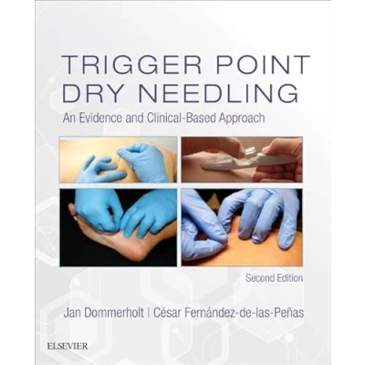 Bild av Trigger Point Dry Needling: An Evidence and Clinical Based Approach