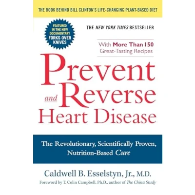 Bild av Prevent and Reverse Heart Disease: The Revolutionary, Scientifically Proven, Nutrition Based Cure