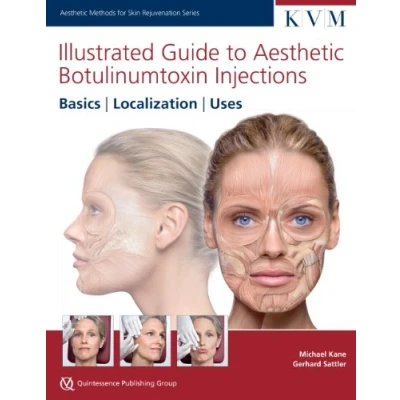 Bild av Illustrated Guide to Aesthetic Botulinum Toxin Injections: Basics, Localization, Uses